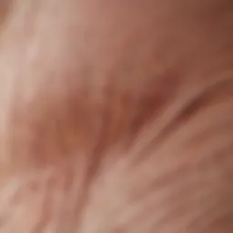 Illustration of skin layers showing hair follicles