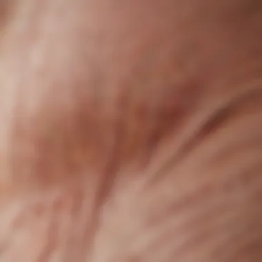 Understanding Skin Layers and Hair Follicles Illustration of skin layers showing hair follicles