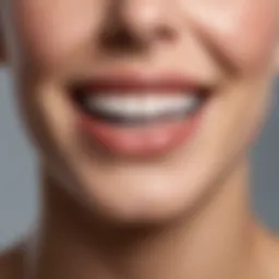 Professional teeth whitening procedure illustration