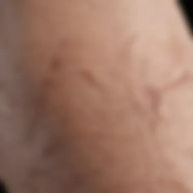 Close-up of dry, cracked elbow skin illustrating a dermatological issue