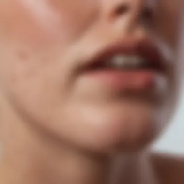 Close-up view of pustule acne on the chin