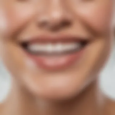 Bright smile with White Stripes teeth whitening