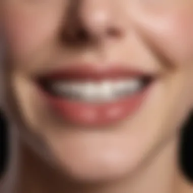 White Stripes teeth whitening results comparison